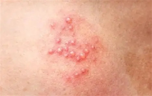详细说明