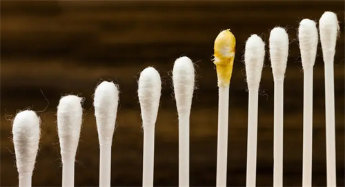 细节介绍