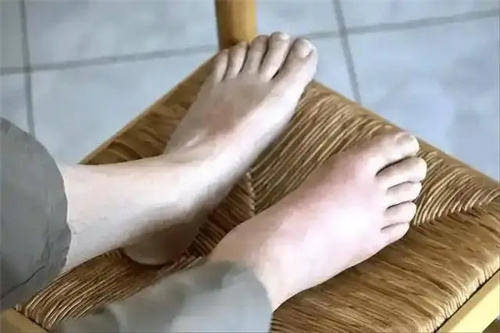 详细说明