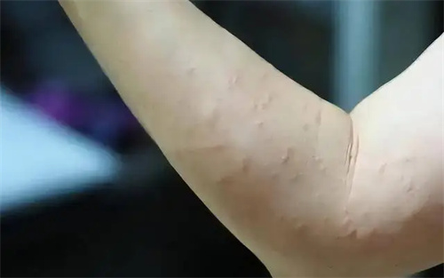 细节介绍