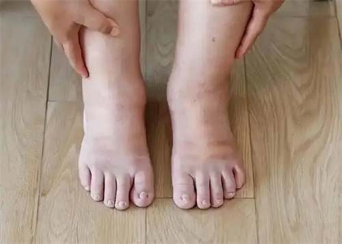 细节呈现