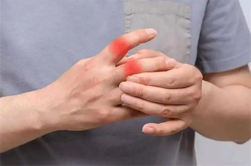细节呈现