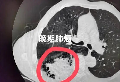 细节描述