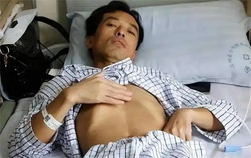 细节介绍