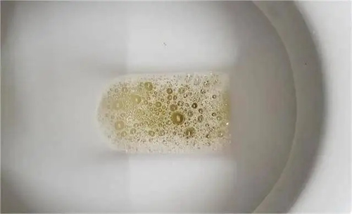 详细说明