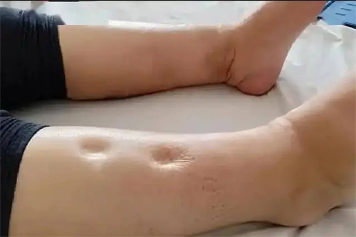 细节说明