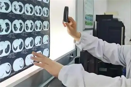 详细展示