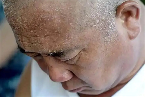 细节说明
