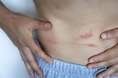 细节说明